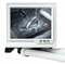 Фото - Система водяного охолодження Asus ROG Ryujin III 360 ARGB Extreme White (90RC0132-M0EAY0) | click.ua