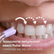Фото - Іригатор Philips Sonicare Power Flosser 3000 Series HX3826/24 | click.ua