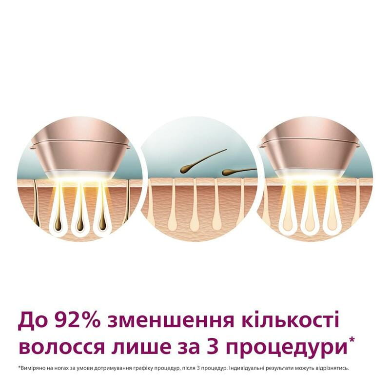 Фотоепілятор Philips Lumea Series 9900 BRI973/00